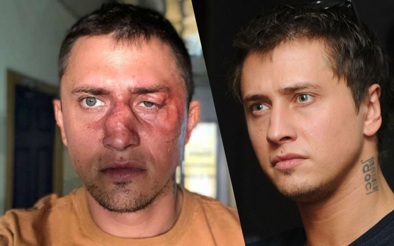 Звезду «мажора» Павла Прилучного жестоко избили в Москве
