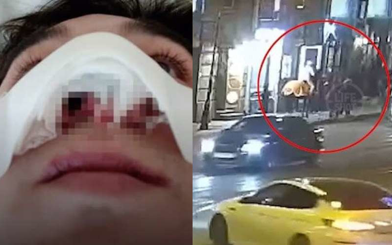 В Санкт-Петербурге конь откусил мужчине нос, когда он лез к нему целоваться
